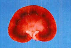 normale Katzenniere